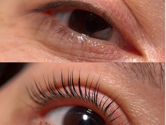 lash-lift3-mspa